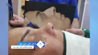 فیلم عمل زیبایی بینی  توسط دکتر نبی پور
