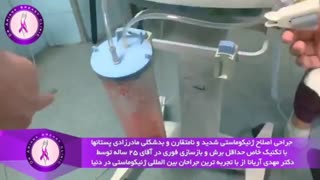 جراحی اصلاح ژنیکوماستی مادرزادی