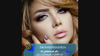 فیلم عمل ترمیم بینی مدلینگ عزیز