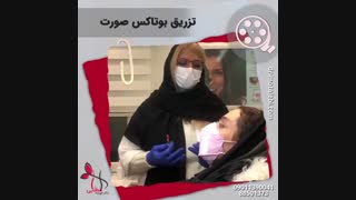 فیلم واقعی تزریق بوتاکس صورت