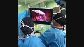 جراحی بای پس معده بیمار با شاخص توده بدنی 45