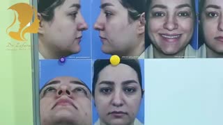 فیلم جالبی از جراحی بینی یک خانم