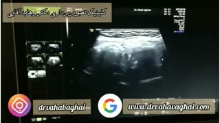 نکات مهم در مورد سونوگرافی نسج نرم و غده تیروئید