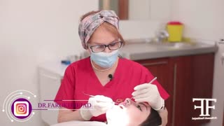 بررسی کامپوزیت های زیبا جوی عزیز