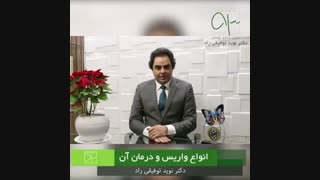 صحبتهای دکتر نوید توفیقی راد در مورد انواع واریس