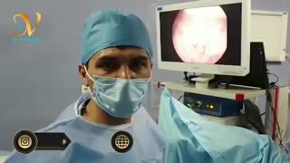 تومورهای سطحی مثانه