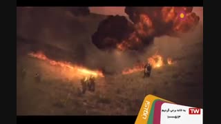 وطنم _ حجت اشرف زاده دندانپزشکی کودکان