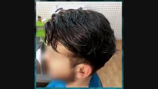 بهترین مارک پروتز مو مردانه 09198858620