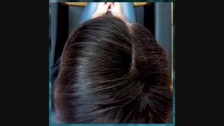 پوستیژ مو طبیعی و ثابت مردانه زنانه 09198858620