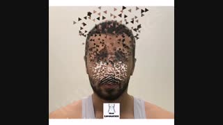 اصلاح گوش برجسته به روش جراحی