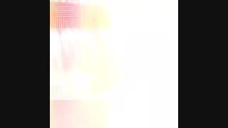 پروتز مو فروشی 09198858620