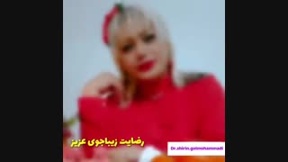 رضایت زیباجوی عزیزی از عمل بینی