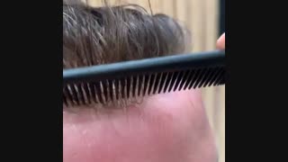 پروتز مو کم پشت  09198858620