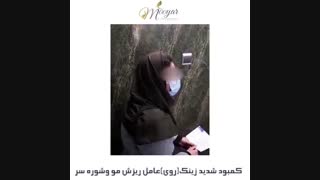 کمبود شدید زینک