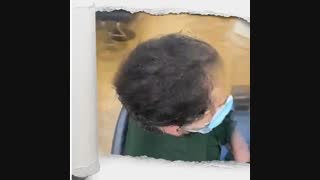 درمان بیماری طاسی 09198858620