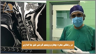 فیلم واقعی جراحی دررفتگی مهره گردن