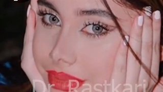 نمونه کار واقعی جراحی زیبایی بینی پس از عمل