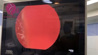 جراحی سینوس