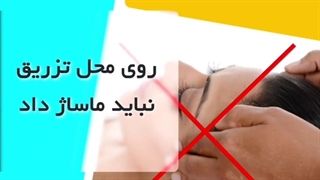 مراقبت های بعد از بوتاکس