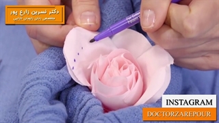 مراحل انجام لابیاپلاستی