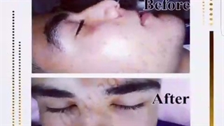 خدمات تخصصی پوست و مو در تهران