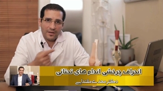 انحراف چرخشی اندام های تحتانی را از زبان بهترین متخصص ارتوپد