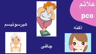 متفورمین و PCO