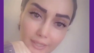 یک سال بعد از عمل جراحی بینی