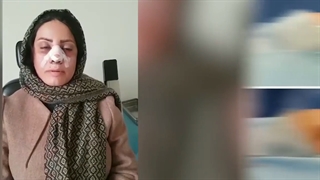 یک روز بعد از عمل بینی