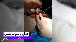 فیلم عمل بینی
