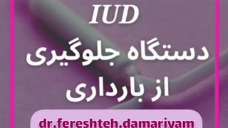 iud دستگاه جلوگیری از بارداری