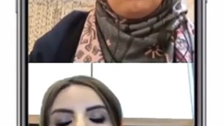 فیلم واقعی از عوارض تزریق بوتاکس