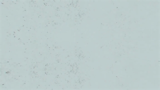 رضایتمندی بیمار عزیزمون از جراحی لاپاراسکوپی (رحم و تخمدان ) توسط خانم دکتر چراغی