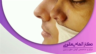 بلافاصله پس از جراحی بینی