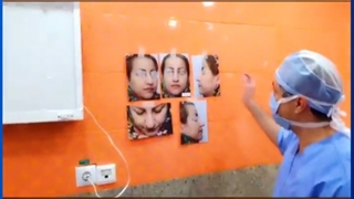 جراحی زیبایی بینی