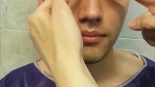 جراحی رینوپلاستی زیباجوی عزیزمون