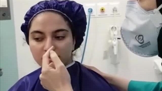 رینوپلاستی بینی گوشتی خانم جوان
