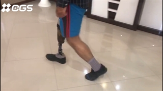 نصب پنجه کربنی CGS برای مراجعه کننده عزیز