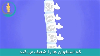 پوکى استخوان
