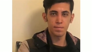 جراحی بینی گوشتی و نافرم به همراه قوس بینی