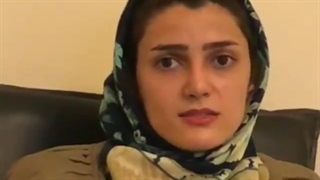 سه ماه بعد از جراحی بینی