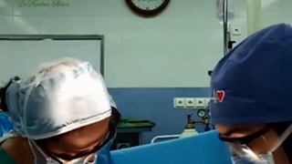 فیلم واقعی سزارین