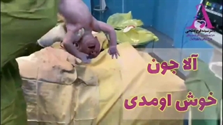 فیلم واقعی سزارین- آلا جان - دکتر ابطحی ساری