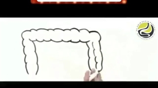 فیلم بیماری التهابی روده