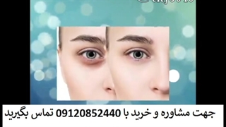 کرم دور چشم صمیم چجوری بخرم؟ 09120852440