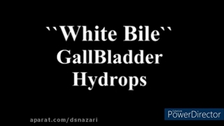 موکوسل کیسه صفرا
