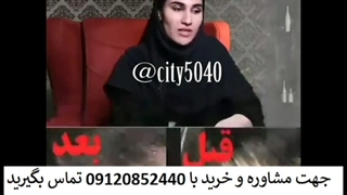 نظر مشتری شامپو ریز رایس را بشنوید لطفا